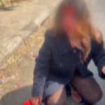 بالصورة- مجهولون يعتدون بالضرب على شابة سورية في البداوي شمالي لبنان