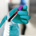 فحص دم قد يكشف ٥٠ نوعاً من السرطان… ما هو؟